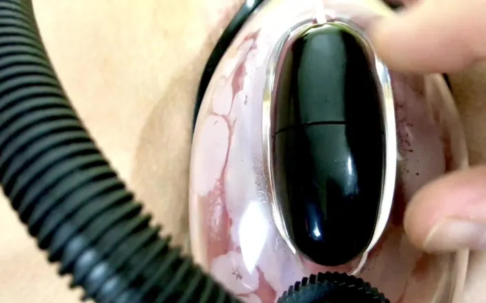 Anna Shpilman: Vaginal Deformation Under the Influence of a Vacuum Pump