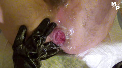 Marcus Pollack Gay: Dobrý přítel mě fistuje v průmyslových gumových rukavicích