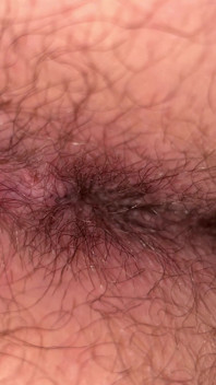 Close up Hairy Hole