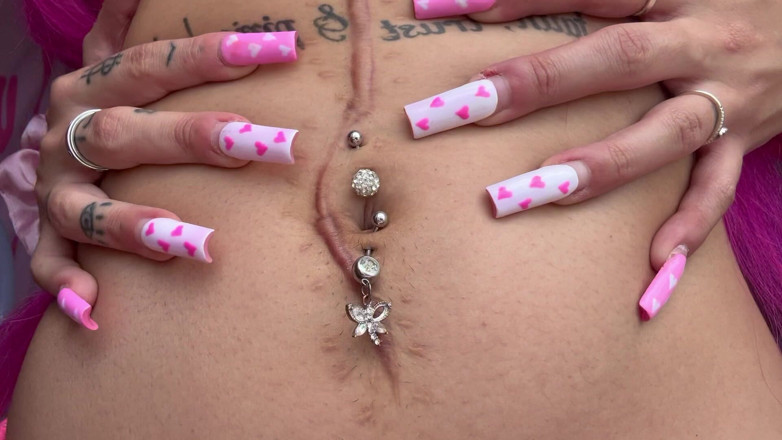 Nali Marie: Belly Button Stretching Scar Stretching Hole Stretch Pulling Scar Pulling...