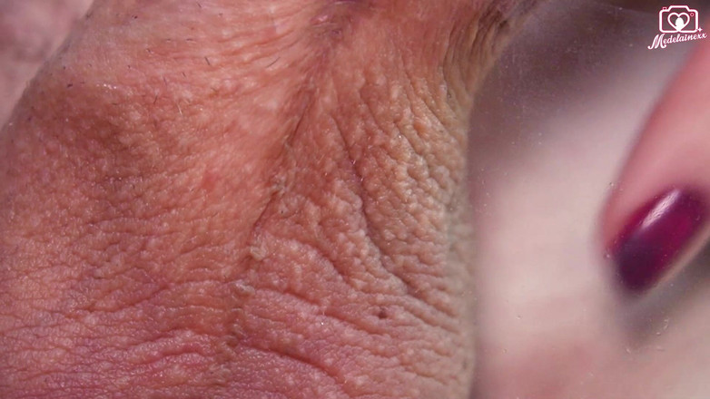 Medi Voi: Pemicu Kamera POV