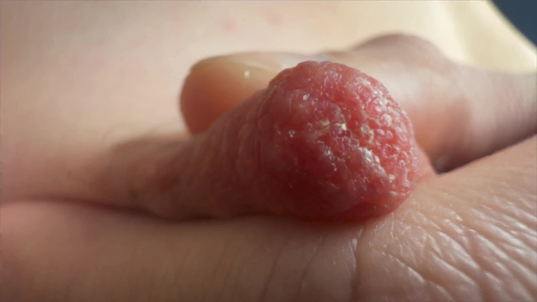 Skinny_lady69: Bradavky Super zblízka