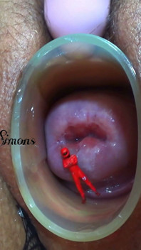 This Is What My Cervix Looks Like After a Year Without Seeing It.