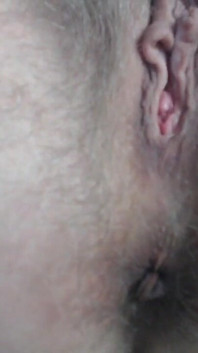 Prolapse Play Close up