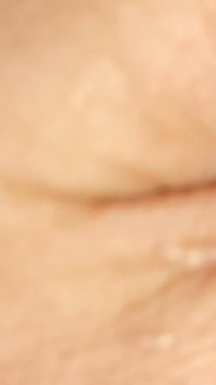 Extreme Insertion Into the Glans of the Pointed Straw.