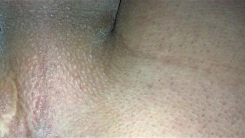 Idmir Sugary: Throbbing Perineum Close up While Cumshot