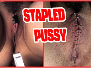 Sadistic Doctor Closes and Staples His Patient's Pussy