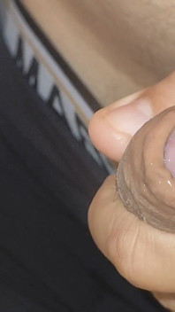 Amazing Upright Rough Venous Frenulum.