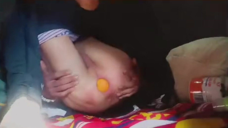 Culopeke: Un Joven Se Mete Una Bola De Cristal Y Una...