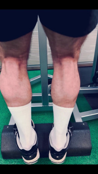 My Legs