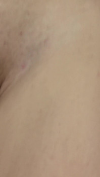 Skye Blue - Erotic Nudes