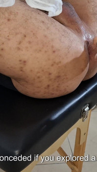 Andò dall'Urologo perché non provava più piacere e lei gli impicciò il suo strapon fino a quando non venne.