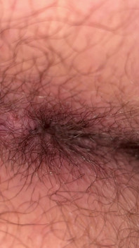 Close up Ass