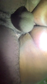 Best Cellulite Ever