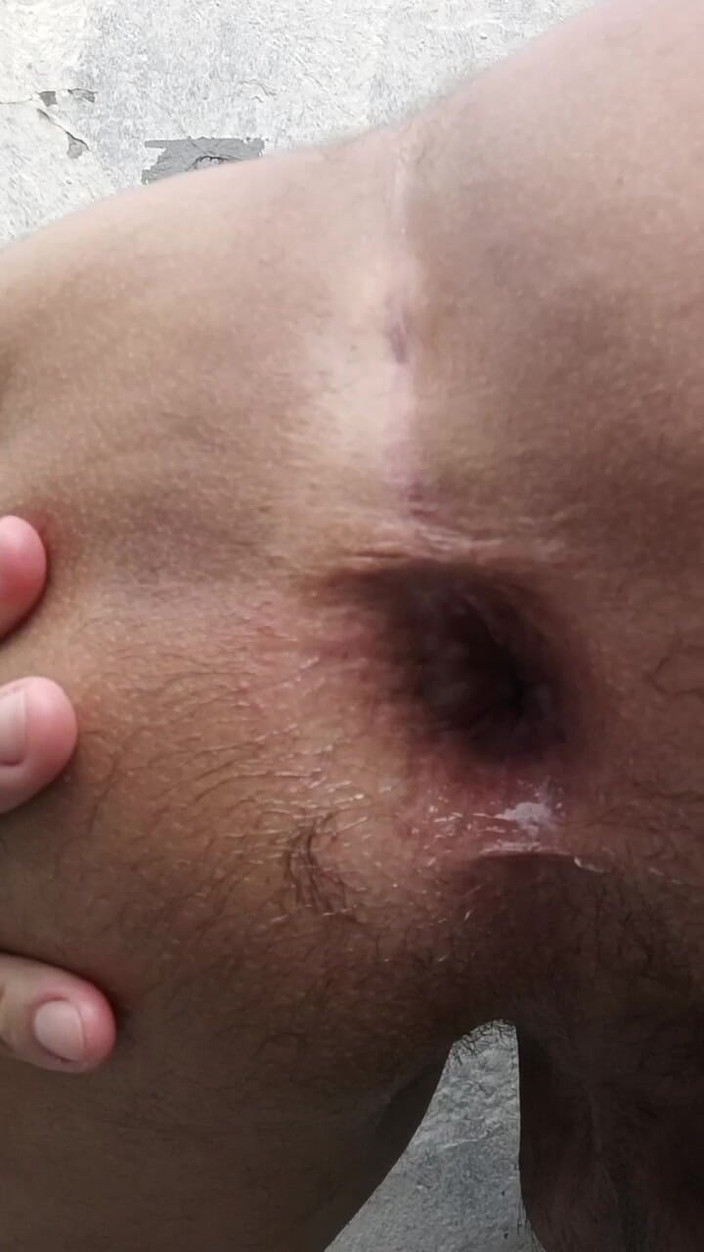 MiguellTrajano: Teď mám sexy zadek