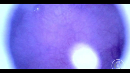 Lina Free: Mooie binnenkant pov van mijn volle blaas met de endoscoop!