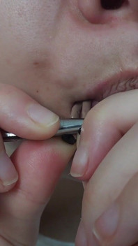 Ma demi-sœur géante joue au dentiste avec son demi-frère minuscule,