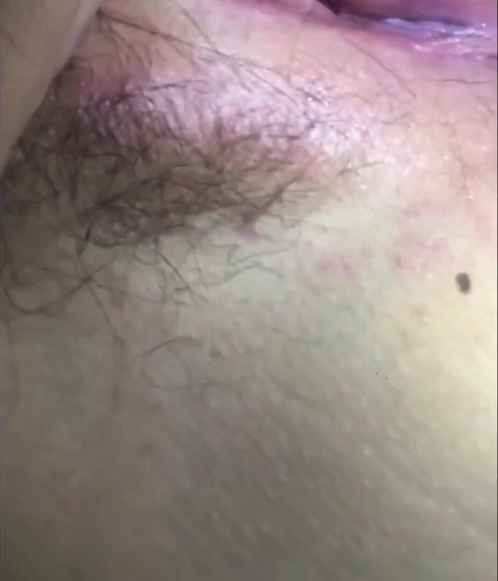 Hashini Hirunika: Digitación parte 2