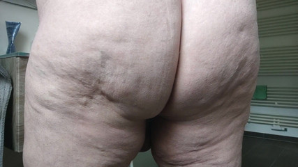 Karlchengeil: my open ass closeup