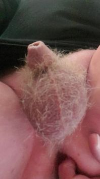 M Tinydick