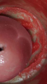 Camera bên trong chụp crempie