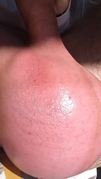 Eier in der Sonne
