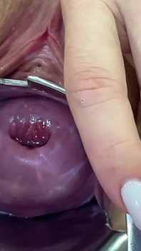 Glass Dildo Cervix Penetration