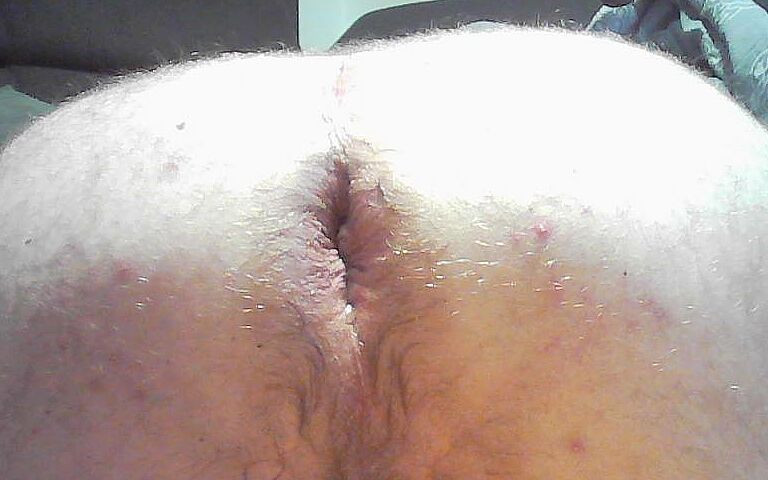 Anal Treating My Ass (Dildomann)