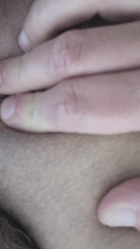 Dirty Anus