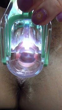 Observação vaginal em Cusco