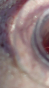 The Little Test with the Anal Tunnel