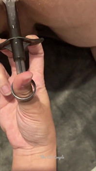 注射器による肛門潤滑剤の塗布