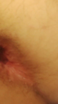 Gape Anus Femboy Slut