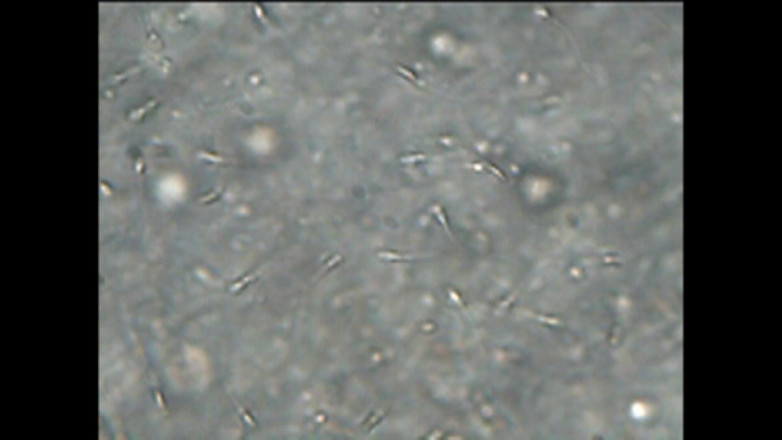 Mark Hannes: Cewek sange ini lagi asik masturbasi pakai sperma hangat di...