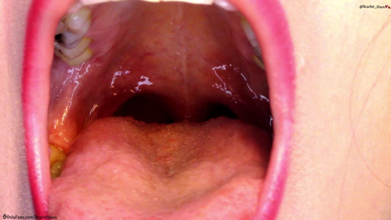 Scarlet Vixen: Hals, uvula und mund zeigen