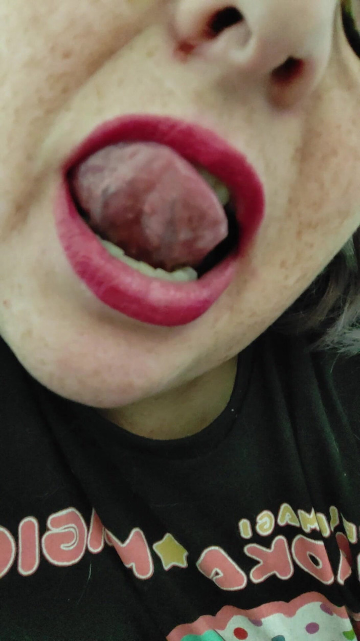 AngYourDirtyCanadian: Close up of My Mouth and Tongue