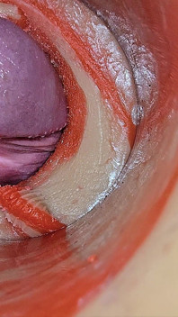 Female Insemination - Internal Camera Captures Deep Male Huge Ejaculation