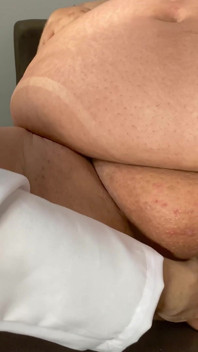 Sestra Angel SSBBW se setká s doktorem pěstí