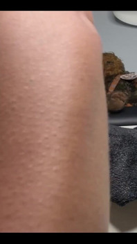 Anal Fail Lmao