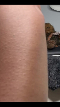 Falta anal de Lmao