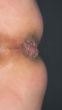 Well Used Hole