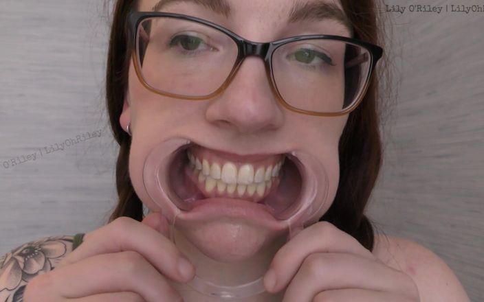 Lily O'Riley: メガネと隙間:11分間の歯科用スペキュラムストレッチドロールセッション