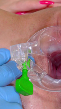 Silicone Sex Bomb Gets Treatment for Her Irritated Cervix