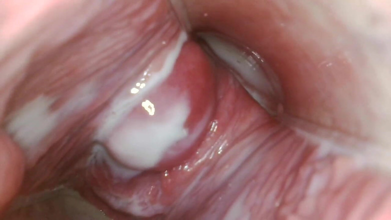 JANA studios: Endoscope in my pussy