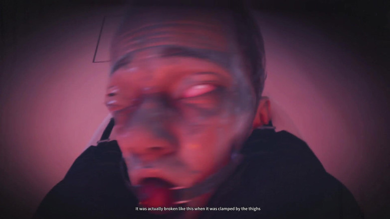 Asdfghjl2025: B010 CBT Sondagem uretral