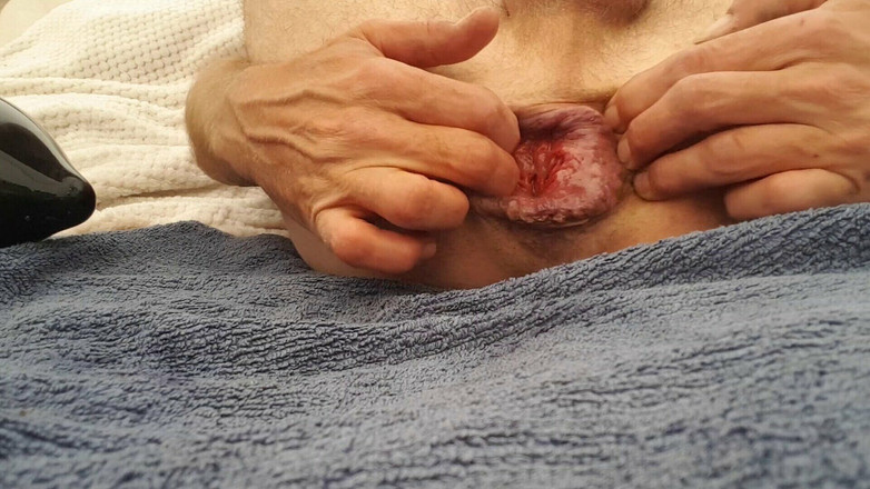 Fistboy: Nafukovací kolík, 7 cm