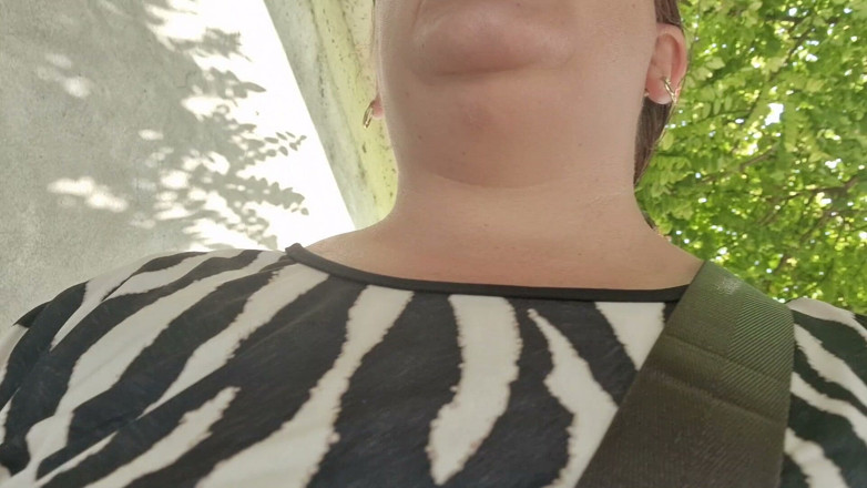 Nicoletta Embassi: Sudden Stomach Cramps a Lot of Farts