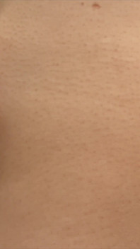 My Bellybutton Has Personality, Muted