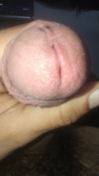 Smegma Big Uncut Smell