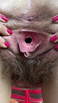 Pepek berbulu mengusik dan ternganga